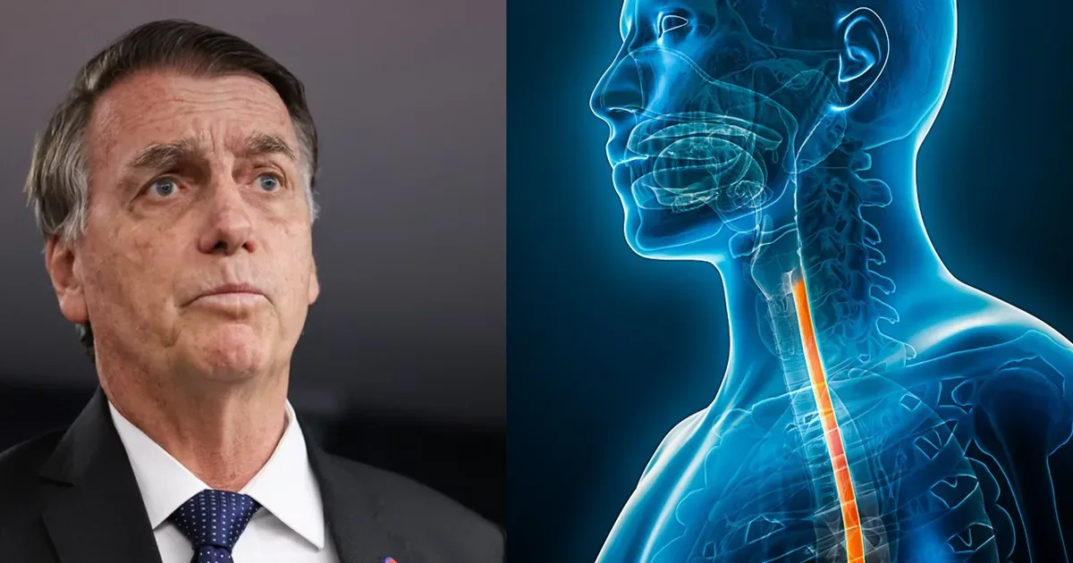 Estado de saúde de Jair Bolsonaro preocupa, diz médico: “Quadro vem piorando"