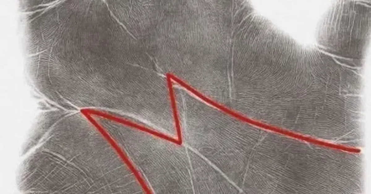 Letra “M” na palma da mão desperta curiosidade e é associada a interpretações populares