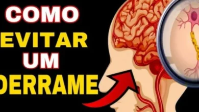 7 Sinais de que um derrame está a caminho e como prevenir um AVC