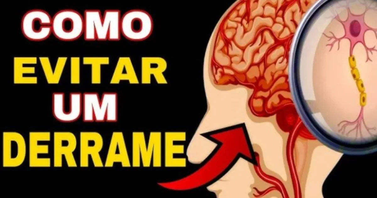 7 Sinais de que um derrame está a caminho e como prevenir um AVC