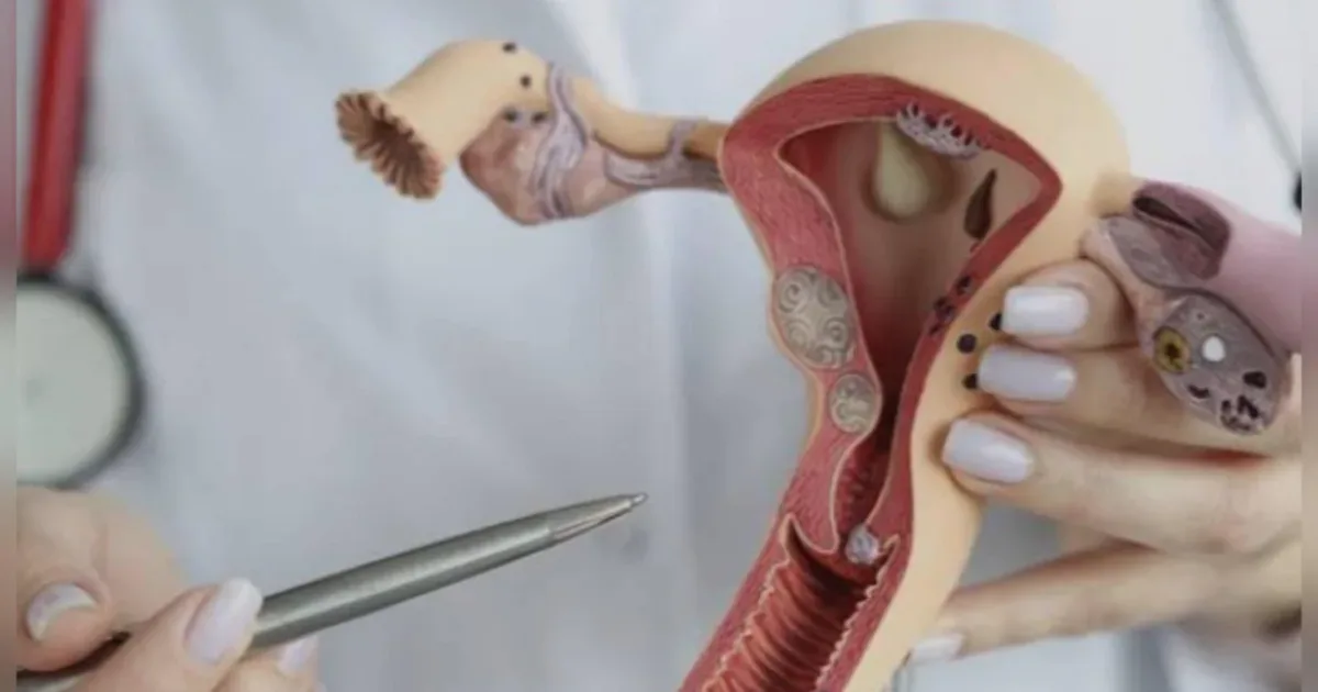 Cinco sintomas de alerta que podem indicar câncer do colo do útero