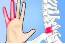 Dormência nas mãos e dedos: Entenda as 10 causas mais comuns e o que fazer