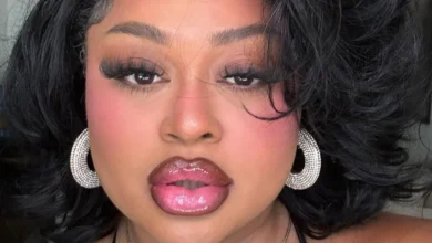 Ex-BBB sofre acidente de trânsito e machuca o rosto