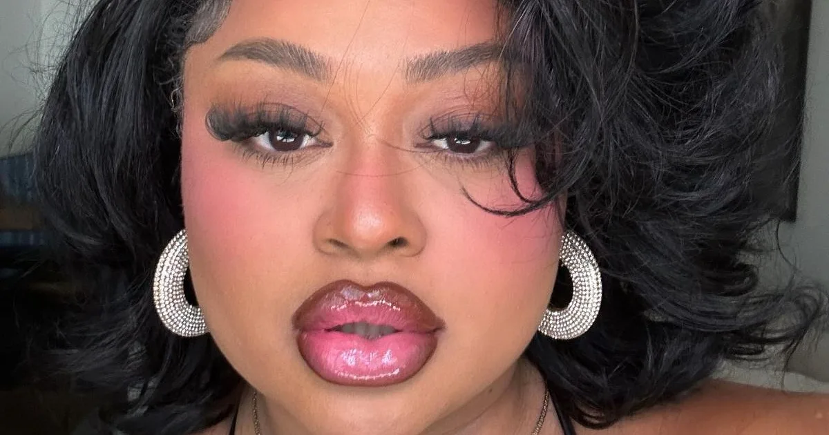 Ex-BBB sofre acidente de trânsito e machuca o rosto