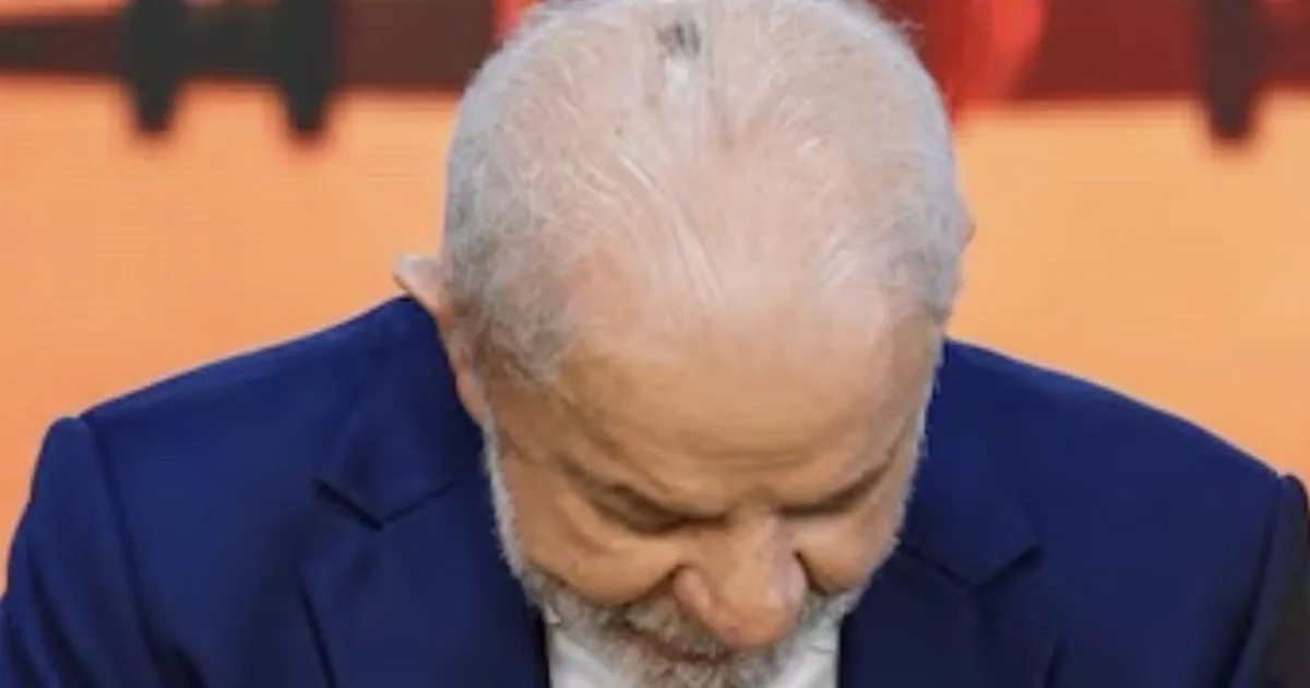 Lula passa por procedimento cirúrgico e notícia é confirmada