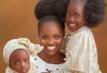 Risikat Ayebami nasceu na Nigéria com condição rara