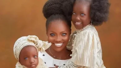 Risikat Ayebami nasceu na Nigéria com condição rara