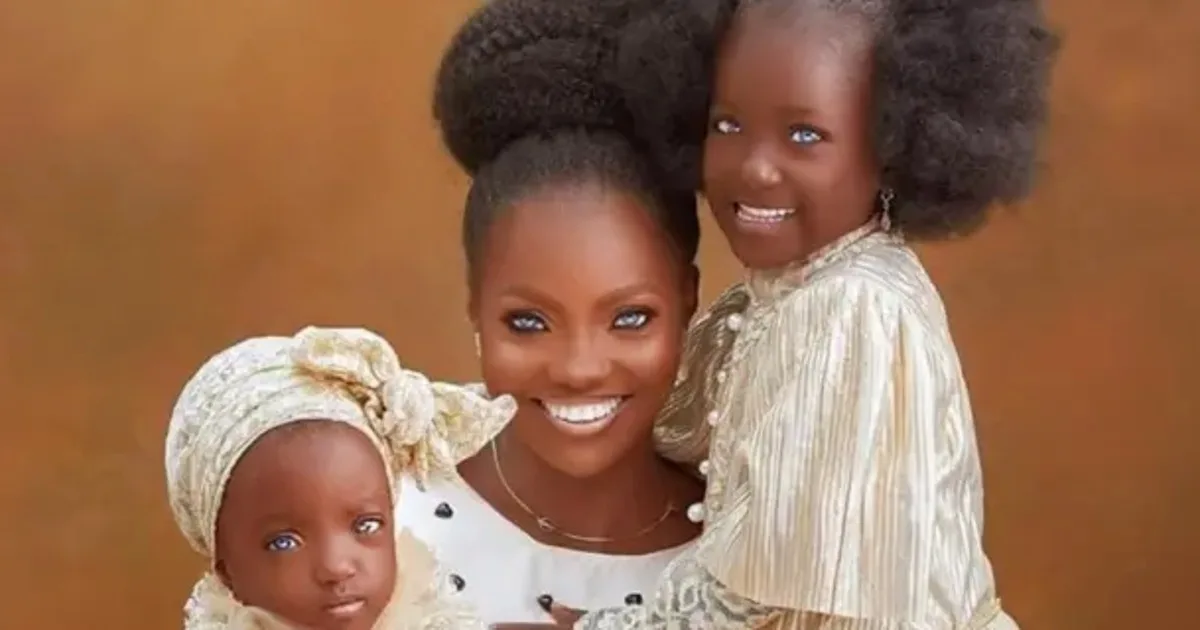 Risikat Ayebami nasceu na Nigéria com condição rara