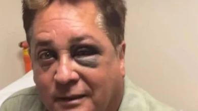 Triste notícia é confirmada sobre o cantor Leonardo