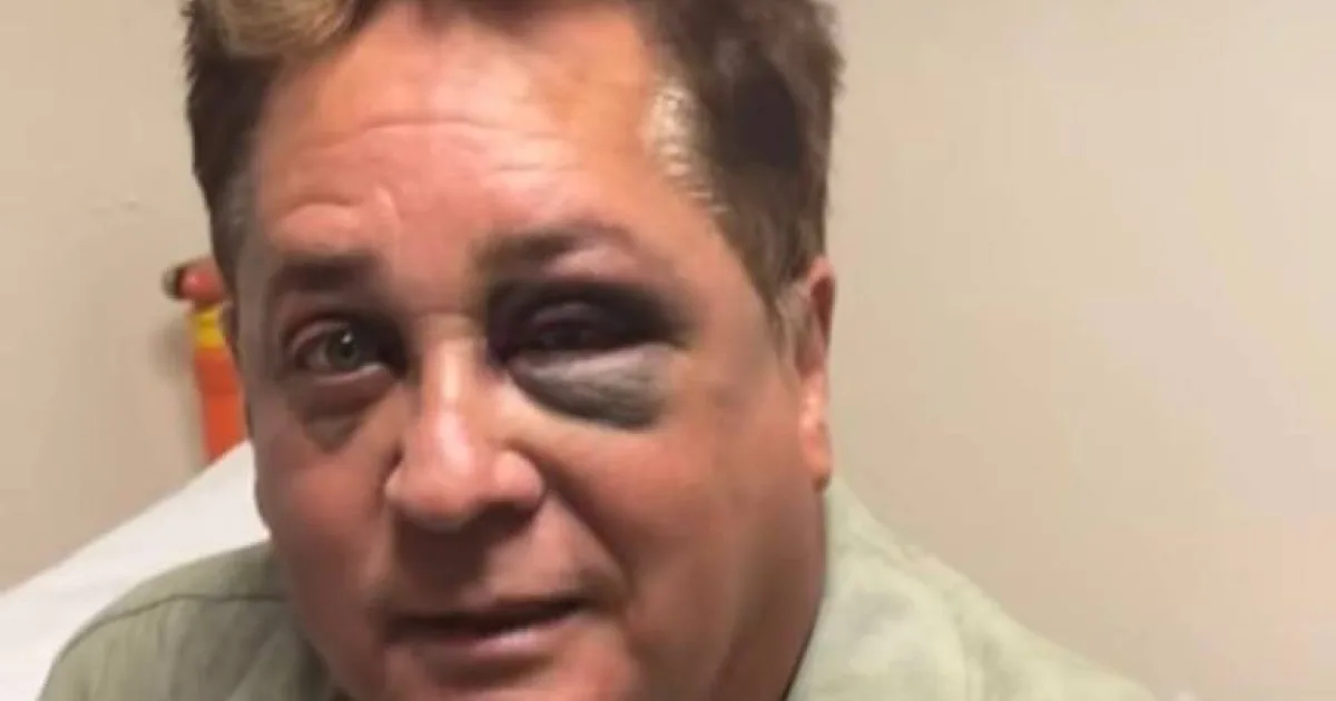 Triste notícia é confirmada sobre o cantor Leonardo