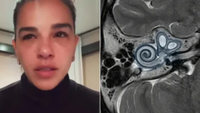 Alerta médico: Mariana Rios compartilha relato sobre diagnóstico de saúde e destaca importância de sintomas iniciais