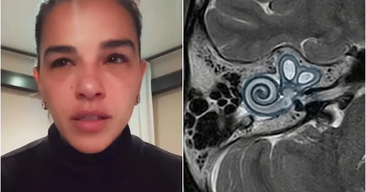 Alerta médico: Mariana Rios compartilha relato sobre diagnóstico de saúde e destaca importância de sintomas iniciais