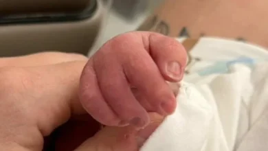 Bebê nasce com “nadadeira da sorte” e emociona