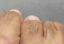 É isso que significa ter pelos nos dedos dos pés