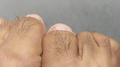É isso que significa ter pelos nos dedos dos pés