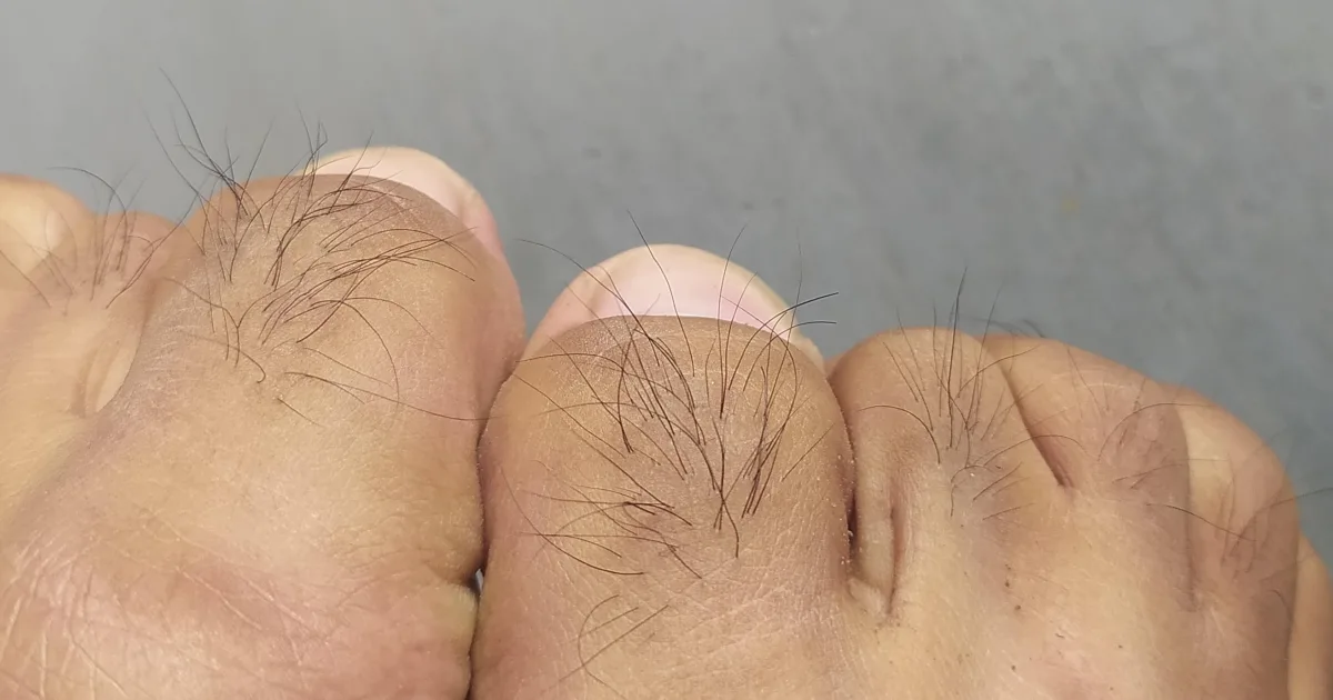 É isso que significa ter pelos nos dedos dos pés