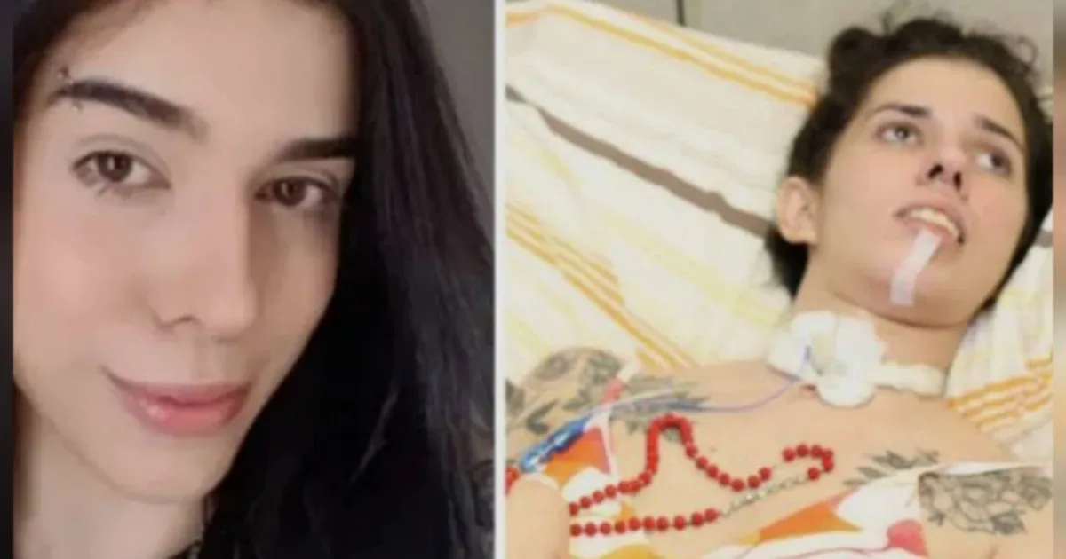 Foi isso que aconteceu com a jovem que cheirou pimenta e teve uma reação