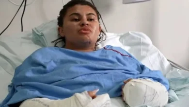 Jovem atacada por namorado fala pela primeira vez