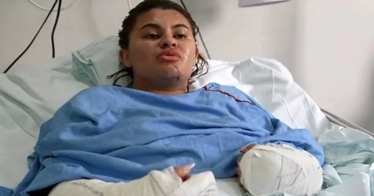 Jovem atacada por namorado fala pela primeira vez