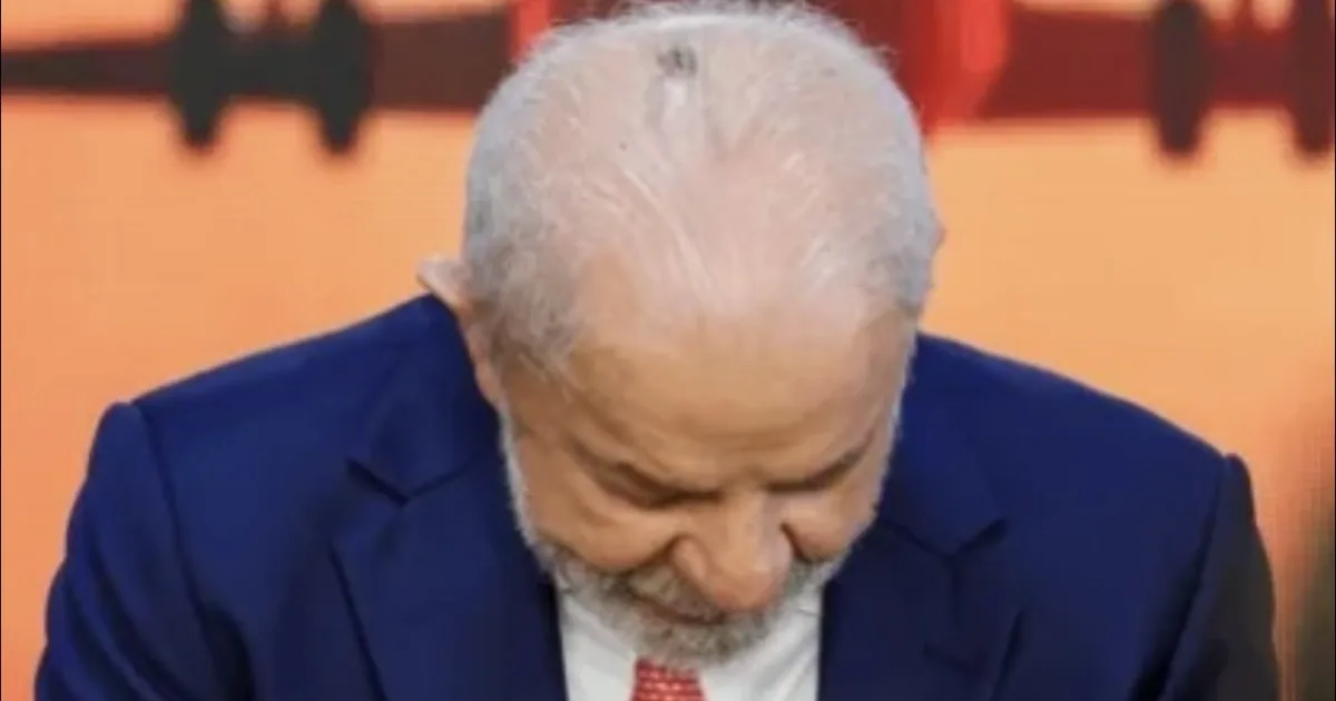 Lula realiza 1ª sessão de radioterapia
