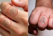 Pelos nas mãos: entenda o que indicam sobre hormônios e saúde