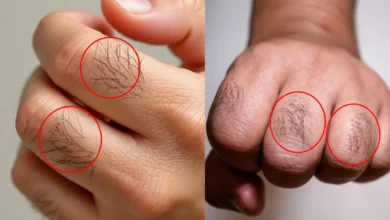 Pelos nas mãos: entenda o que indicam sobre hormônios e saúde