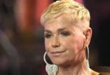 Xuxa passa por tratamento contra doença e passa por transplante