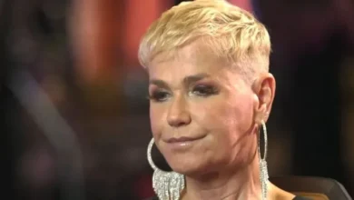 Xuxa passa por tratamento contra doença e passa por transplante