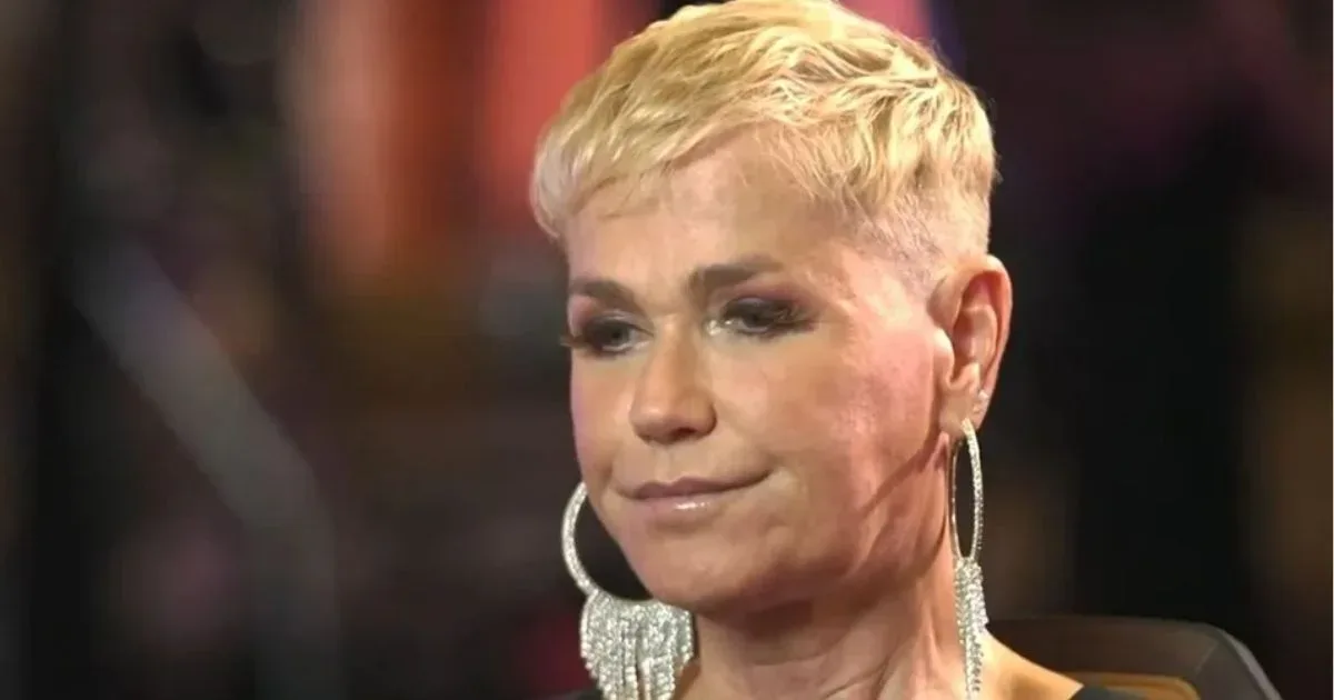Xuxa passa por tratamento contra doença e passa por transplante
