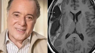 Alerta médico: Especialistas explicam a condição de saúde diagnosticada recentemente no ator Tony Ramos