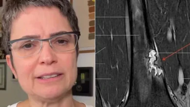 Boletim de saúde: Diagnosticada com problema médico, Sandra Annenberg passa por cirurgia e se recupera