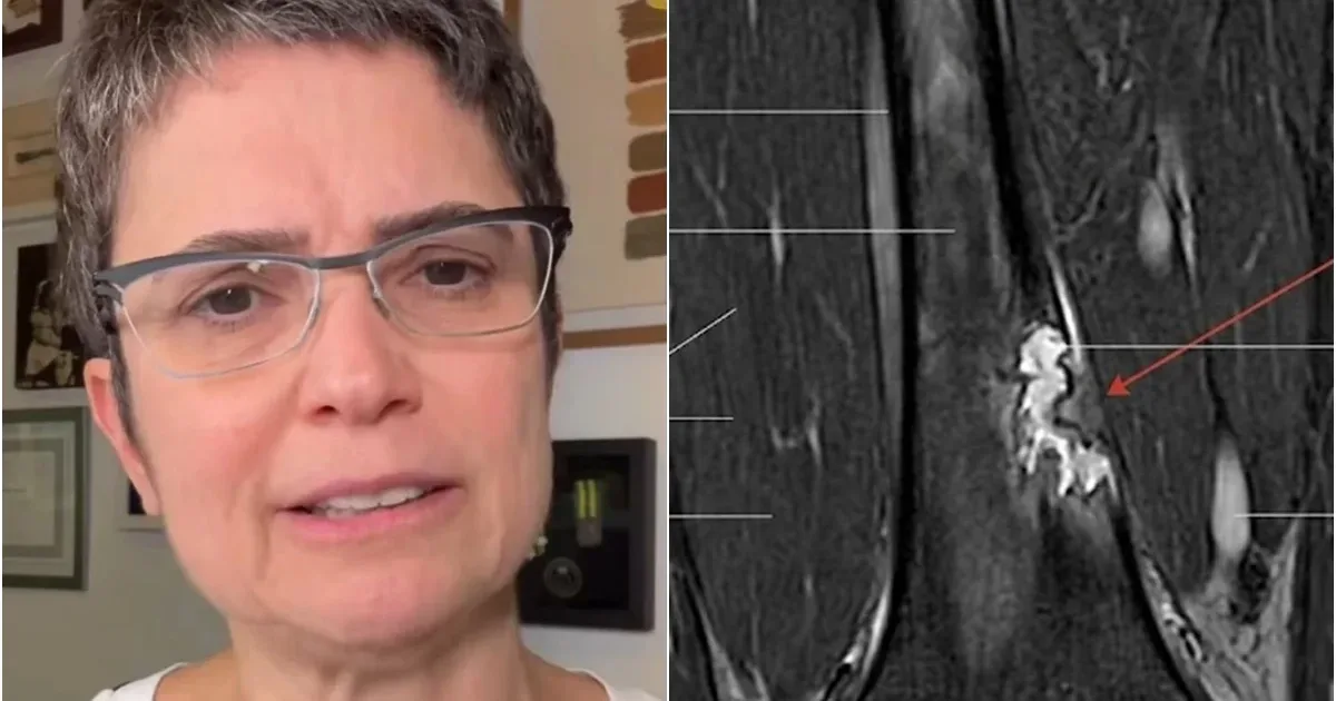 Boletim de saúde: Diagnosticada com problema médico, Sandra Annenberg passa por cirurgia e se recupera