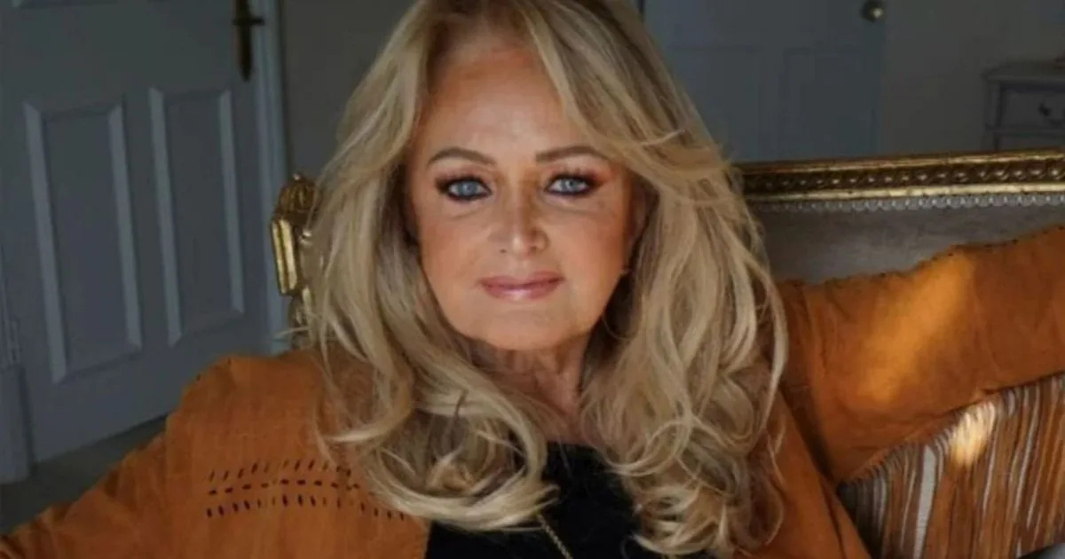 Bonnie Tyler deixa coma induzido e apresenta sinais de recuperação