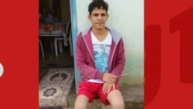 Homem amputa o próprio pé para tentar ganhar um seguro milionário