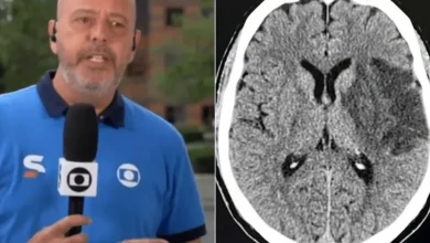 Informações médicas: Especialista analisa sintomas que causaram afastamento do apresentador Alex Escobar