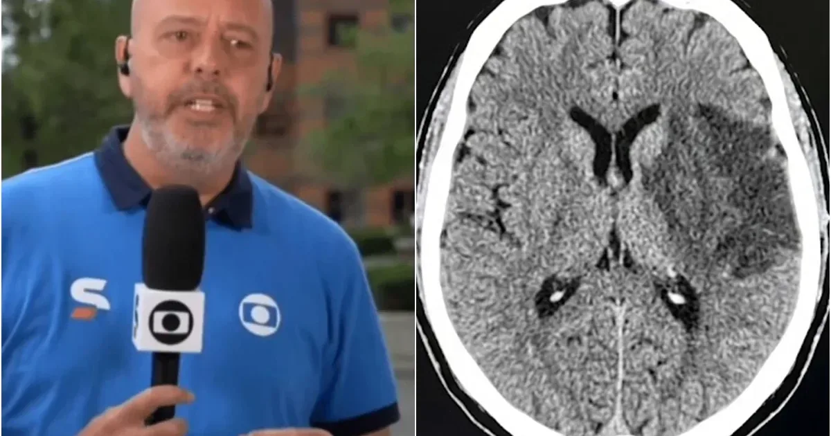 Informações médicas: Especialista analisa sintomas que causaram afastamento do apresentador Alex Escobar