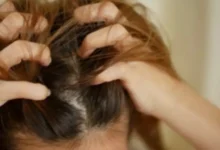 Se sua cabeça coça com frequência, este pode ser um sinal que merece atenção
