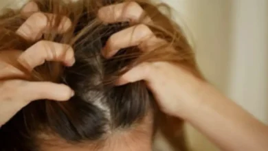 Se sua cabeça coça com frequência, este pode ser um sinal que merece atenção