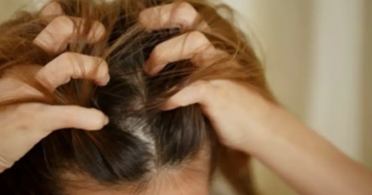 Se sua cabeça coça com frequência, este pode ser um sinal que merece atenção