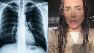 Entenda o quadro de saúde de Letícia Colin após a atriz dar entrada em hospital