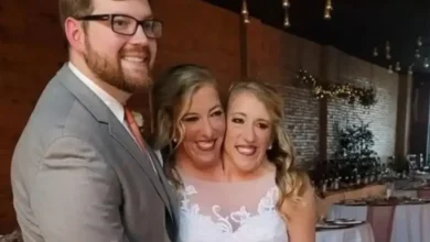 Gêmeas siamesas aparecem com bebê e declaração do marido chama atenção