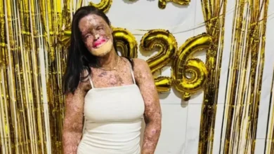 Káh Felipe, influenciadora cearense que inspirou milhares com sua luta contra doença rara, morre aos 37 anos