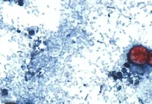 Parasita provoca uma doença que já deixou quase 3 mil pessoas infectadas
