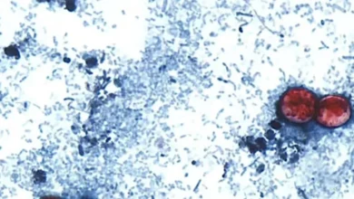 Parasita provoca uma doença que já deixou quase 3 mil pessoas infectadas