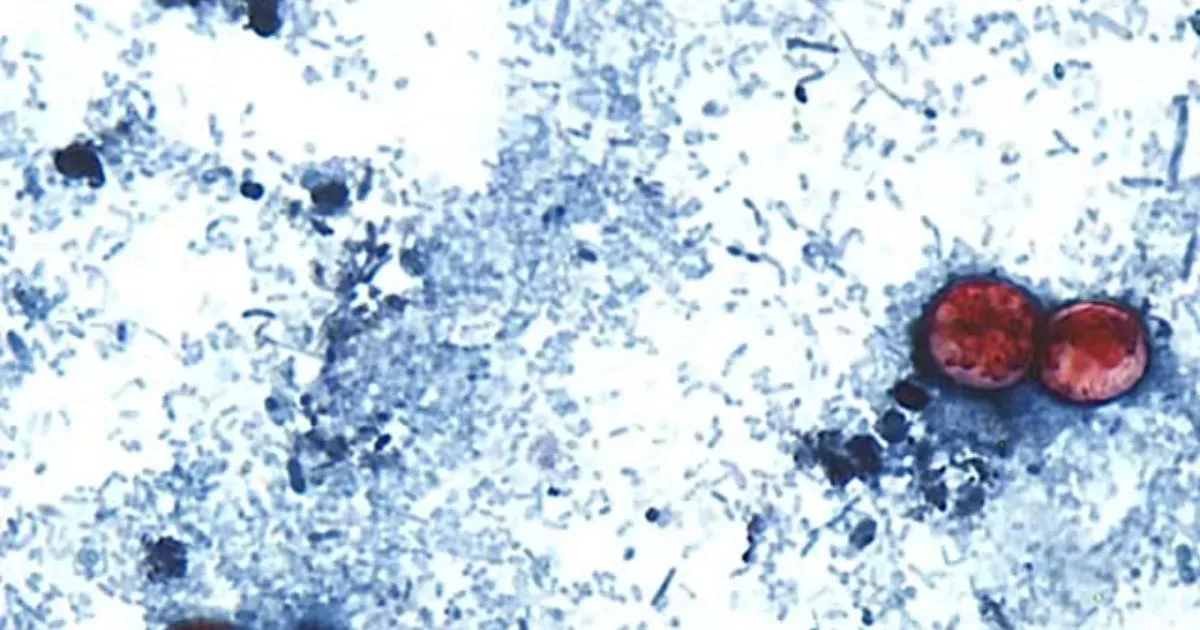 Parasita provoca uma doença que já deixou quase 3 mil pessoas infectadas