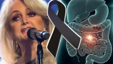 Saiba o que diz o relatório oficial sobre o procedimento cirúrgico e o falecimento de Bonnie Tyler