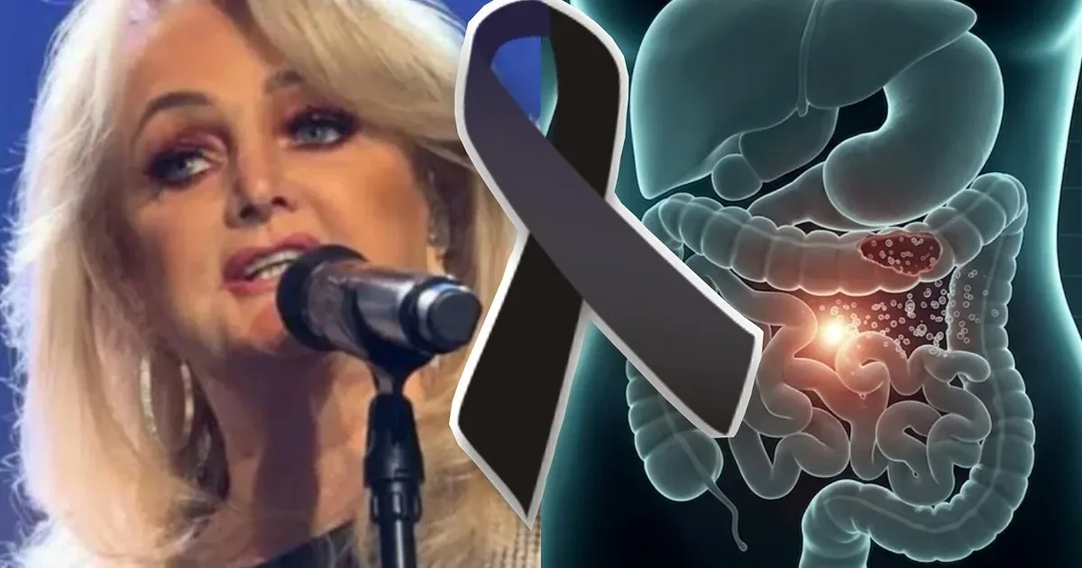 Saiba o que diz o relatório oficial sobre o procedimento cirúrgico e o falecimento de Bonnie Tyler