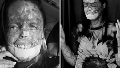 Últimas palavras da Influenciadora Káh Felipe antes de falecer por doença rara comove o Brasil
