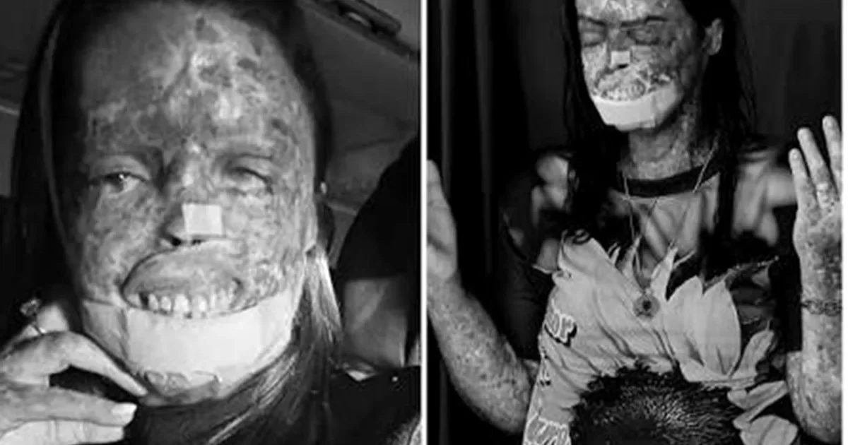 Últimas palavras da Influenciadora Káh Felipe antes de falecer por doença rara comove o Brasil