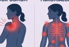 Fibromialgia: sintomas, causas, diagnóstico e formas de controlar as dores